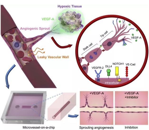 本研究中芯片上VEGF诱导的血管新生的概念图。图片来源：EBioMedicine
