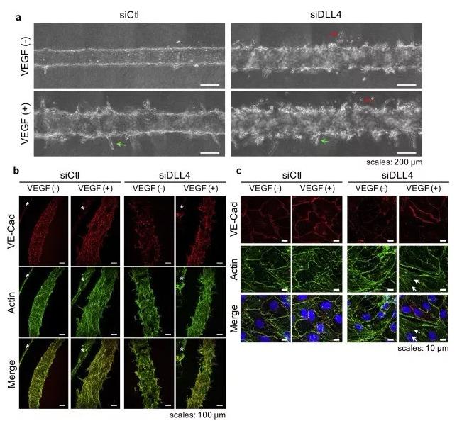 敲除DLL4将影响血管的新生和稳定性。图片来源：EBioMedicine