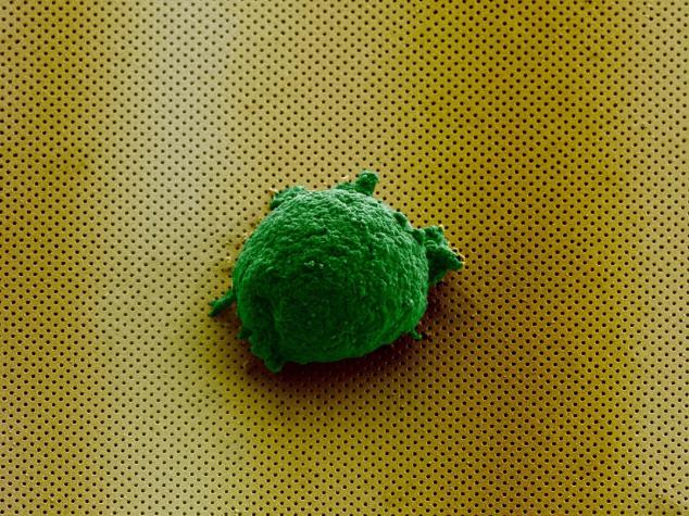 《Small》杂志封面图片显示，单个淋巴瘤细胞孤独地存在于新型生物传感器上。
