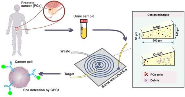有望无创检测前列腺癌的微流控芯片